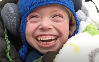 Daniel: Menkes Disease